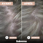 GUMMIES CHEVEUX | GLOW + - Vignette | Baleema