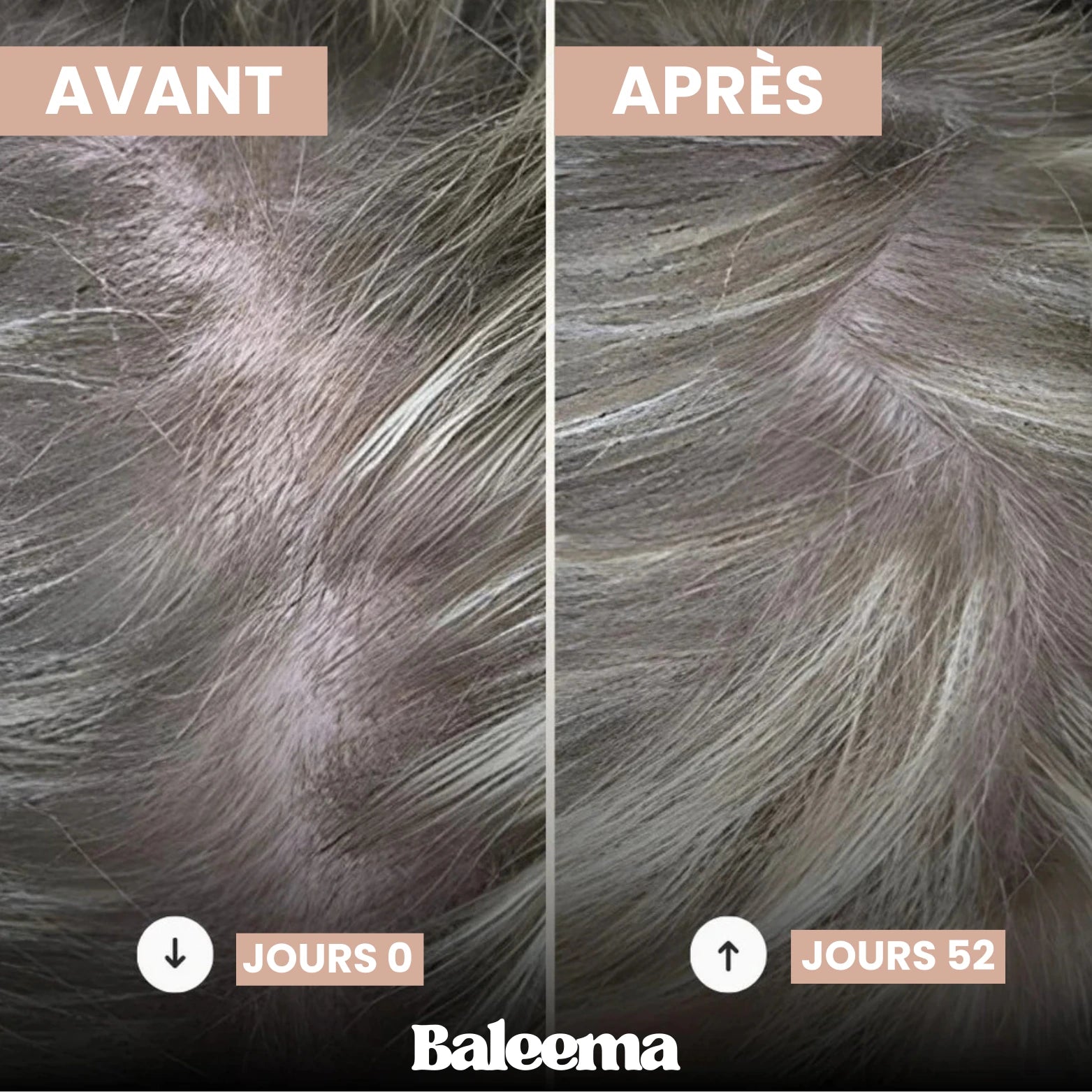 GUMMIES CHEVEUX | GLOW +