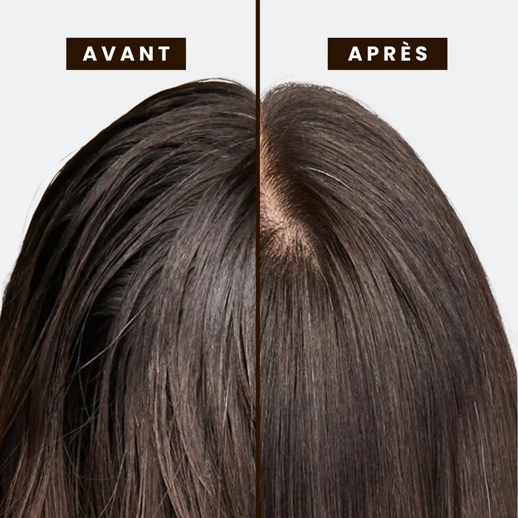 L’HUILE CUIR CHEVELU (30ml)